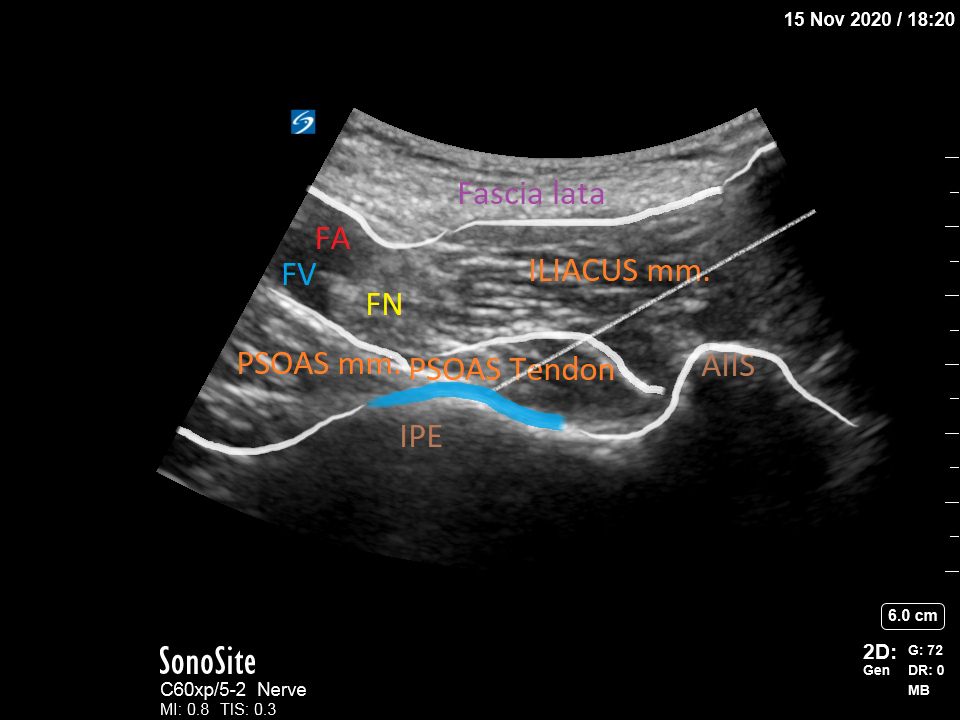 PENG Regional Block Article