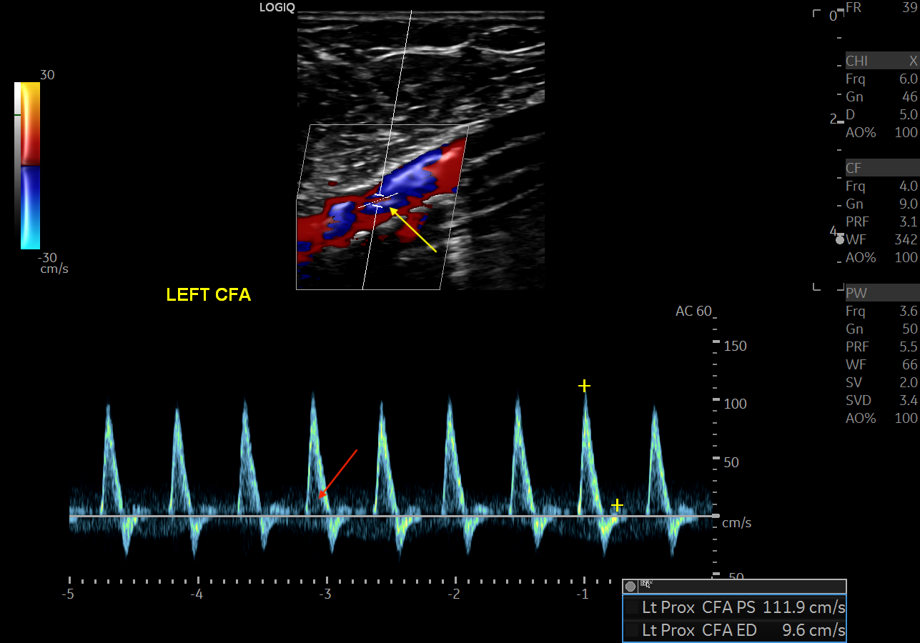 Sonography Vascular And Lymphatic Assessment, Protocols, And ...