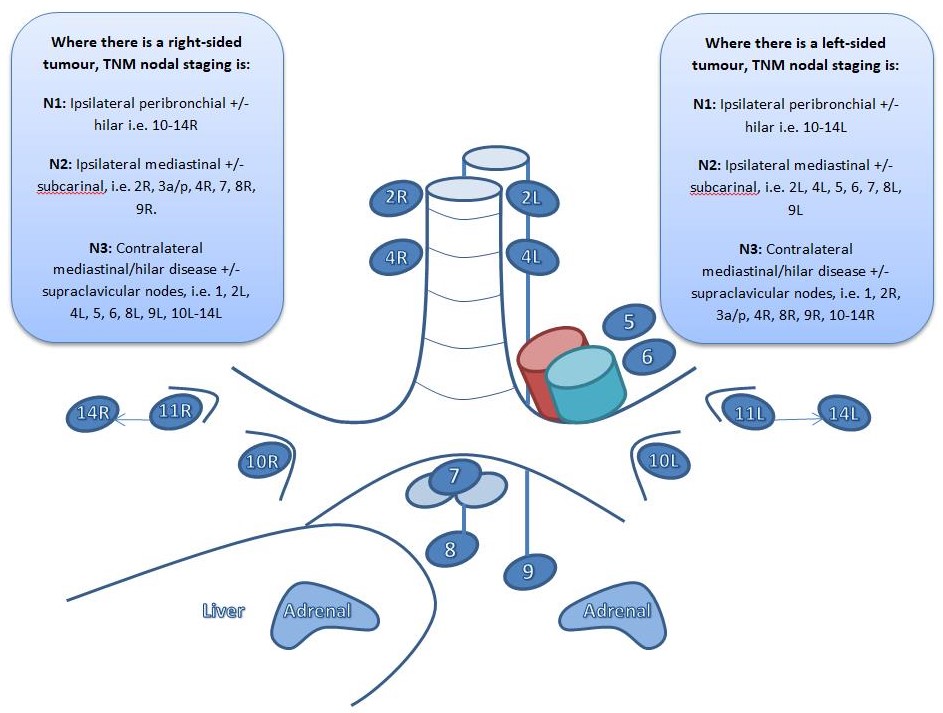 Sonography Endobronchial Assessment, Protocols, And Interpretation Article