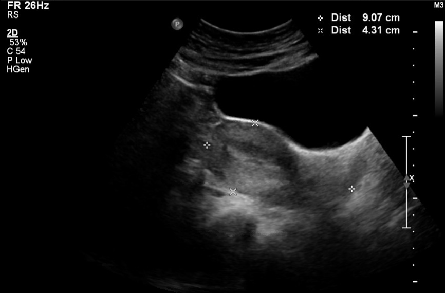 Sonography Gynecology Anatomy and Physiology | Treatment & Management ...