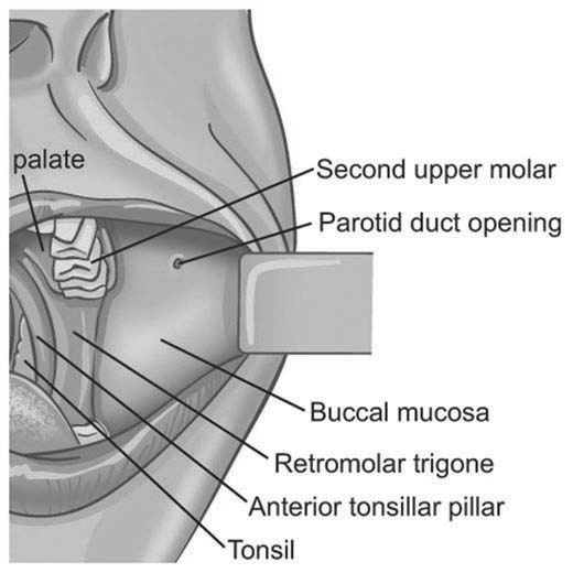 Mucous Membrane Graft Article