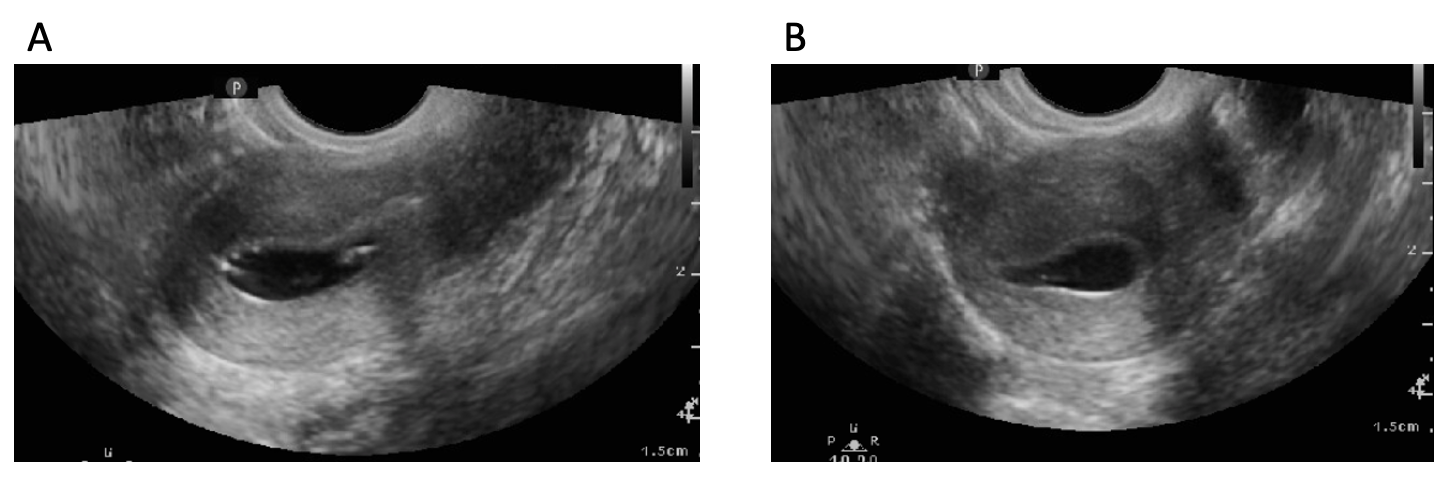 Sonography Gynecology Infertility Assessment, Protocols, And ...