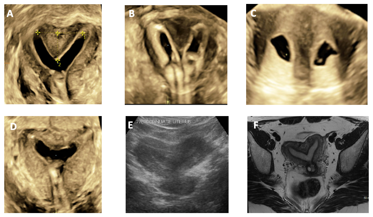 Sonography Gynecology Infertility Assessment, Protocols, And ...