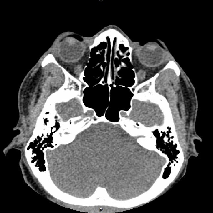 Eye Trauma Imaging Article