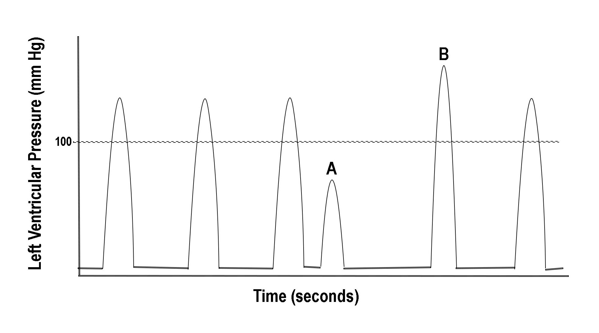 Evaluation Of Suspected Cardiac Arrhythmia Article