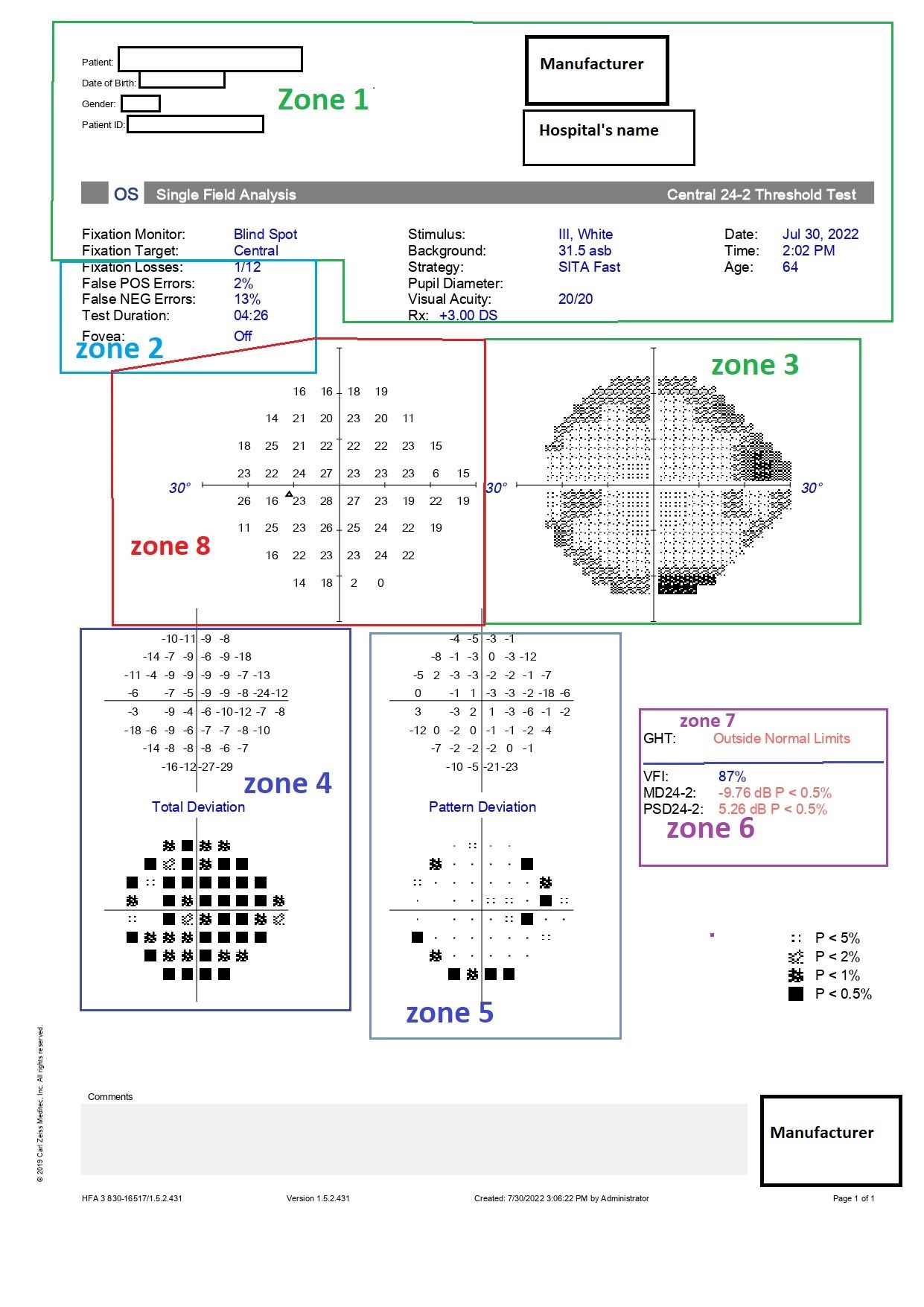 Humphrey Visual Field Treatment And Management Point Of Care