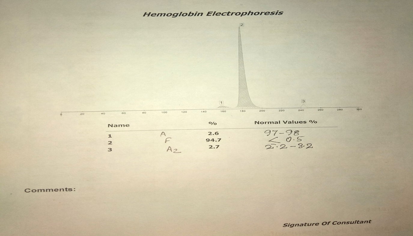 hemoglobin electrophoresis thalassemia        
        <figure class=