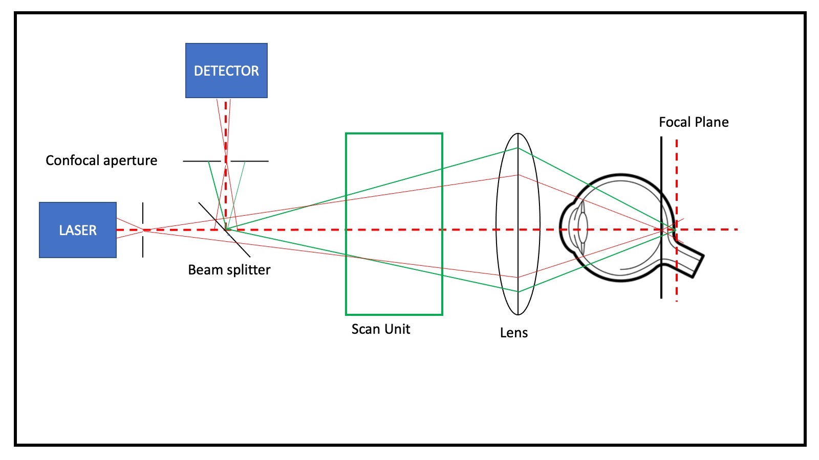 Scanning Laser Ophthalmoscope | Treatment & Management | Point of Care