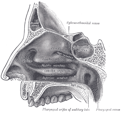 Nasal Septal Hematoma Article