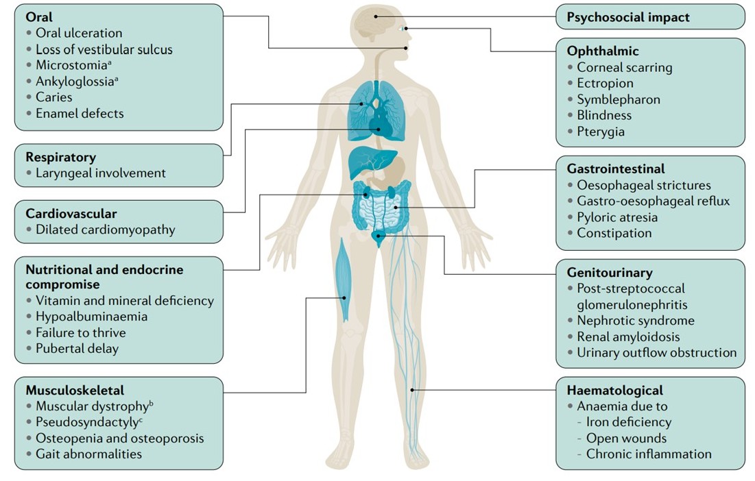 Epidermolysis Bullosa | Treatment & Management | Point of Care