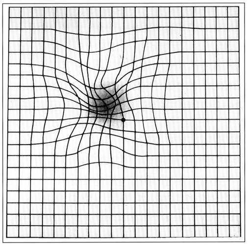 Home Vision Card (Acuity and Amsler Grid)