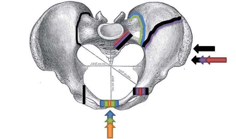 Pelvic Fracture Article