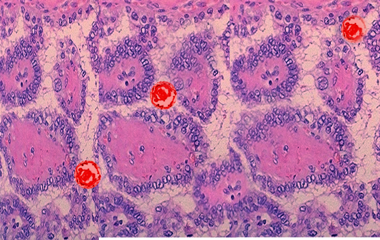 Histology, Thyroid Gland Article