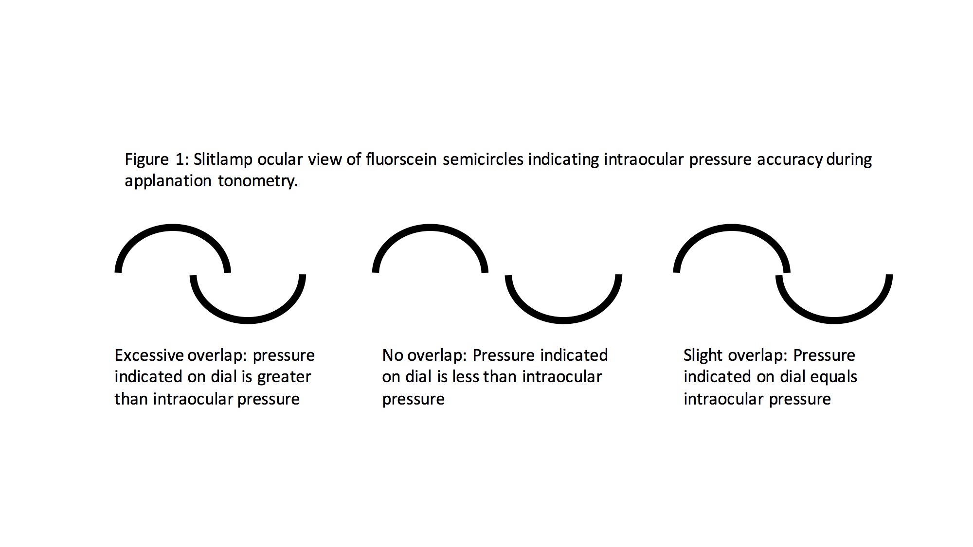 tonometry-article