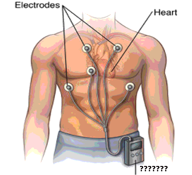 holter-monitor-article