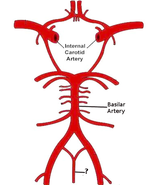 Anatomy, Back, Anterior Spinal Artery 