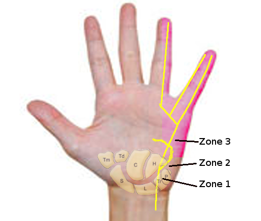 Anatomy, Shoulder and Upper Limb, Hand Guyon Canal Article - StatPearls