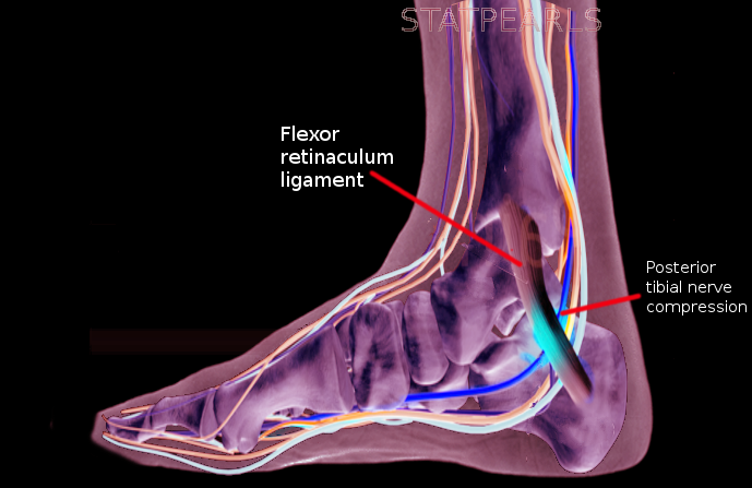 Anterior Tarsal Tunnel