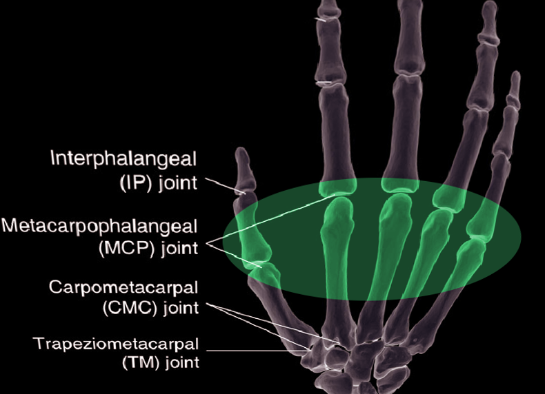 Anatomy, Shoulder and Upper Limb, Metacarpophalangeal Joints ...