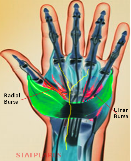 Anatomy, Shoulder and Upper Limb, Hand Ulnar Bursa | Treatment ...