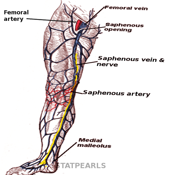 Endoscopic Vein Harvesting Article